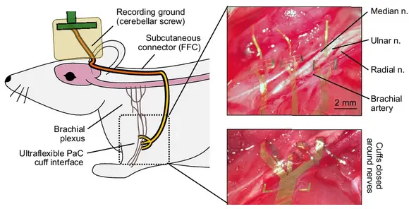 Peripheral Nerve Interface Performance