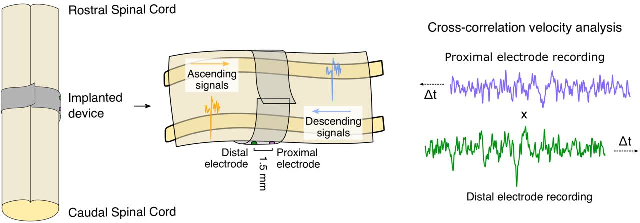 Signal Detection Schematic
