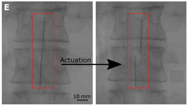 Minimally Invasive Deployment