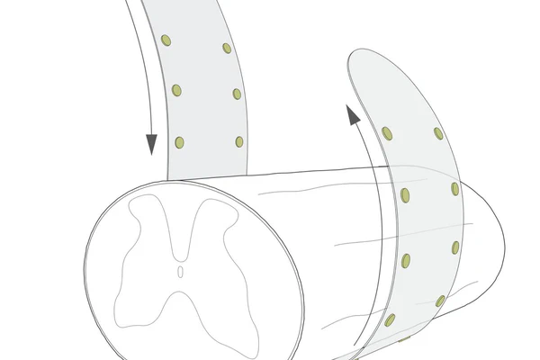 Circumferential Neural Interfacing